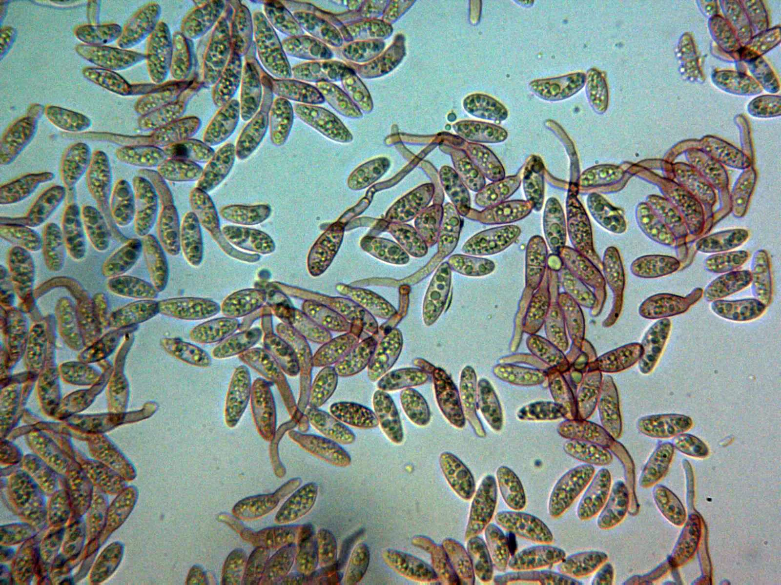 12 - Esporas germinando x 400 2